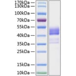 SDS-PAGE - Recombinant Human TNFRSF13C Protein (C-terminal Human Fc and His Tag) (A331346) - Antibodies.com
