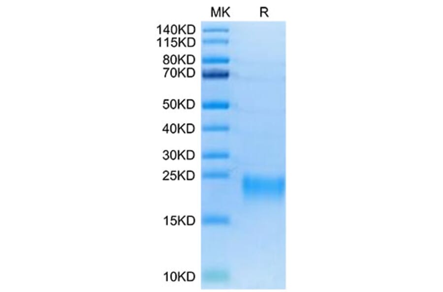 Tris-Bis PAGE - Recombinant Human TNFRSF13C Protein (Biotin) (C-terminal His and Avi Tag) (A331347) - Antibodies.com