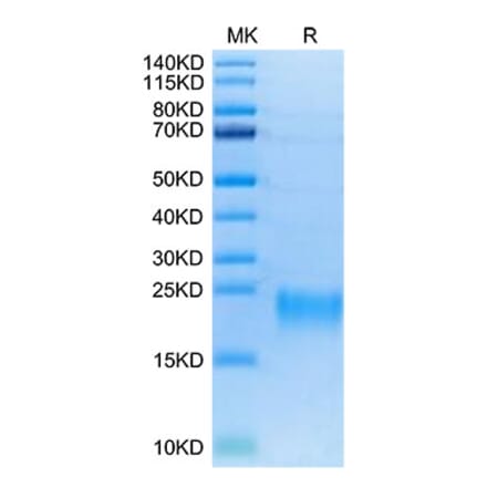 Tris-Bis PAGE - Recombinant Human TNFRSF13C Protein (Biotin) (C-terminal His and Avi Tag) (A331347) - Antibodies.com