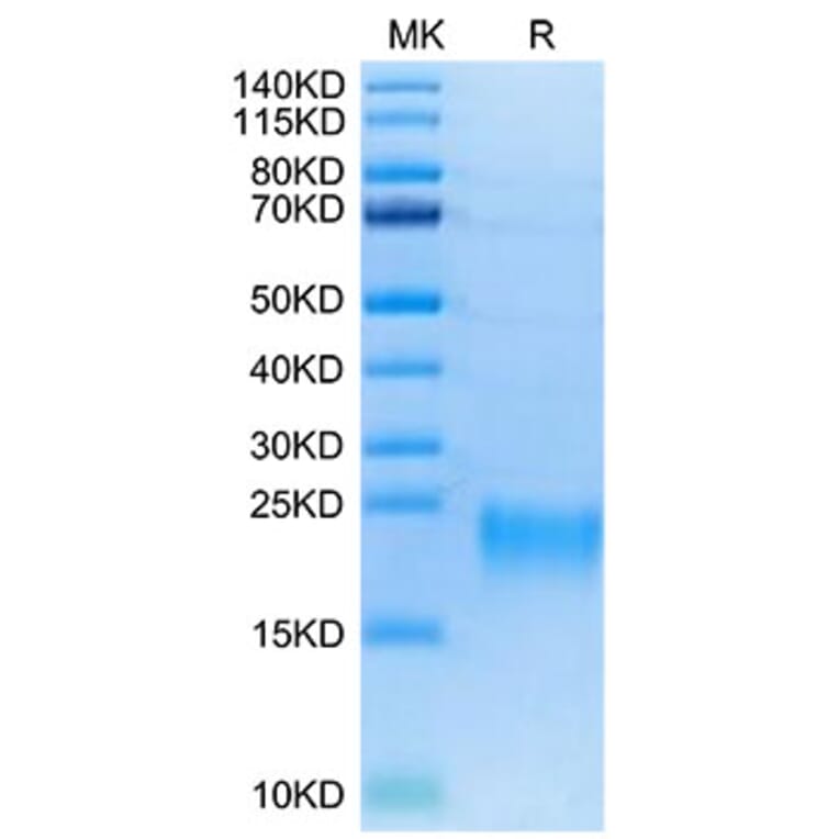Tris-Bis PAGE - Recombinant Human TNFRSF13C Protein (Biotin) (C-terminal His and Avi Tag) (A331347) - Antibodies.com