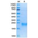 Tris-Bis PAGE - Recombinant Human TNFRSF13C Protein (Biotin) (C-terminal His and Avi Tag) (A331347) - Antibodies.com