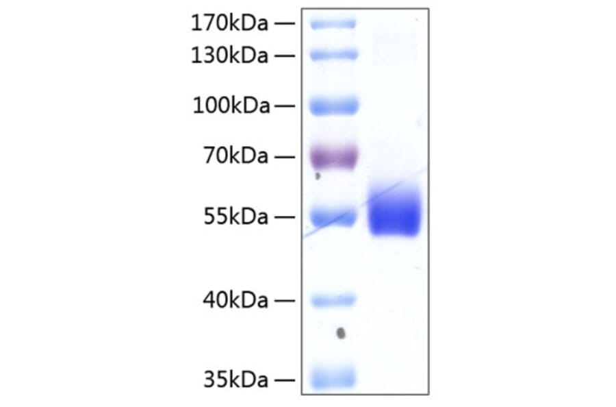 SDS-PAGE - Recombinant Human TNFRSF14 Protein (C-terminal Human Fc and His Tag) (A331348) - Antibodies.com