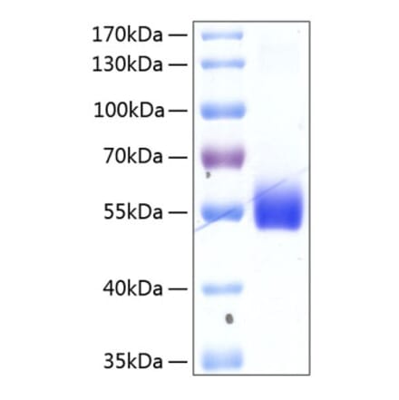 SDS-PAGE - Recombinant Human TNFRSF14 Protein (C-terminal Human Fc and His Tag) (A331348) - Antibodies.com