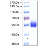 SDS-PAGE - Recombinant Human TNFRSF14 Protein (C-terminal Human Fc and His Tag) (A331348) - Antibodies.com