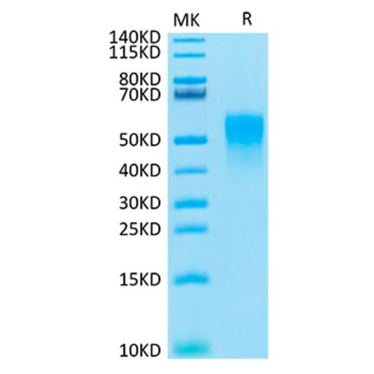 Tris-Bis PAGE - Recombinant Cynomolgus macaque TNFRSF1B Protein (C-terminal His Tag) (A331349) - Antibodies.com