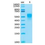 Tris-Bis PAGE - Recombinant Cynomolgus macaque TNFRSF1B Protein (C-terminal His Tag) (A331349) - Antibodies.com
