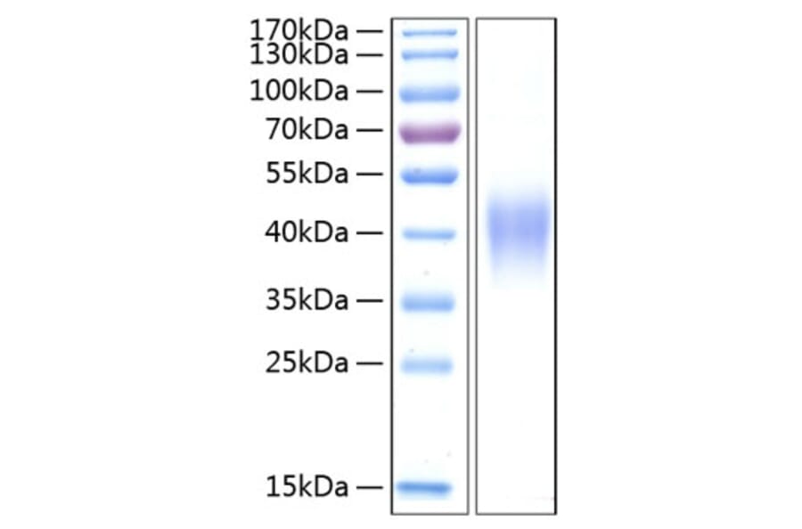 SDS-PAGE - Recombinant Human TNFRSF1B Protein (C-terminal His Tag) (A331350) - Antibodies.com