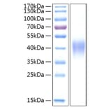 SDS-PAGE - Recombinant Human TNFRSF1B Protein (C-terminal His Tag) (A331350) - Antibodies.com