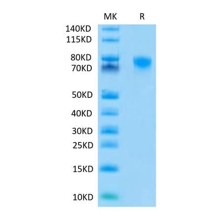 Tris-Bis PAGE - Recombinant Human TNFRSF1B Protein (C-terminal Mouse Fc Tag) (A331351) - Antibodies.com