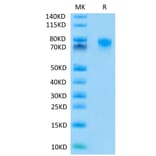 Tris-Bis PAGE - Recombinant Human TNFRSF1B Protein (C-terminal Mouse Fc Tag) (A331351) - Antibodies.com