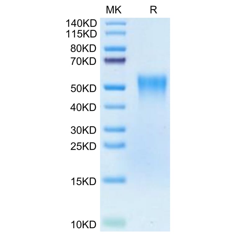 Tris-Bis PAGE - Recombinant Human TNFRSF1B Protein (Biotin) (C-terminal His Tag) (A331352) - Antibodies.com
