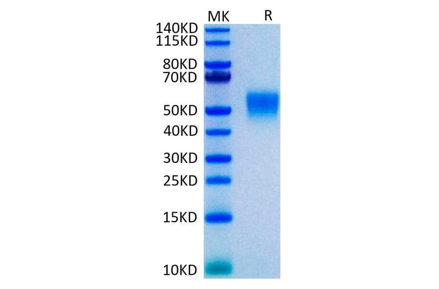 Tris-Bis PAGE - Recombinant Human TNFRSF1B Protein (C-terminal His Tag) (A331353) - Antibodies.com