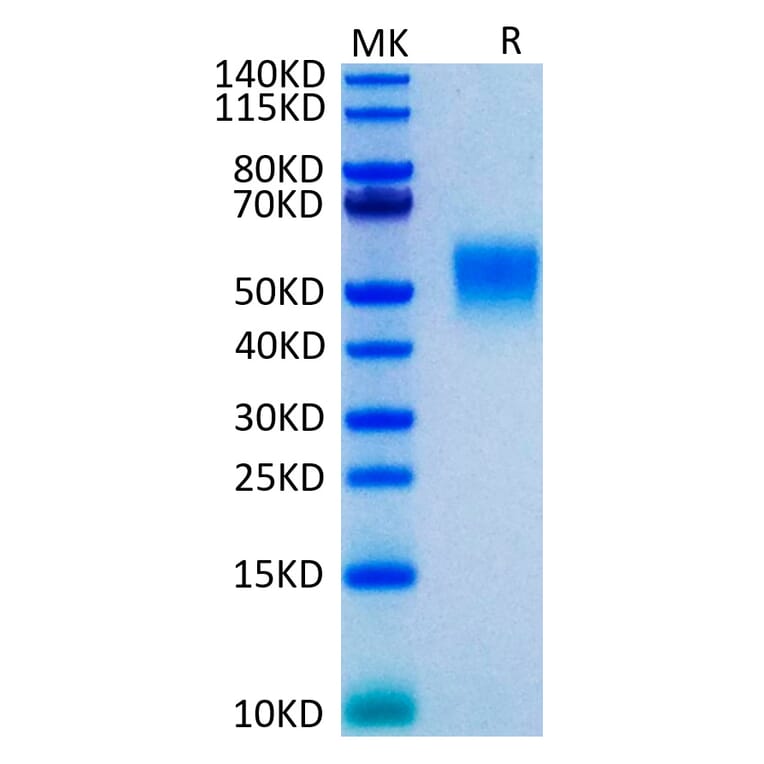 Tris-Bis PAGE - Recombinant Human TNFRSF1B Protein (C-terminal His Tag) (A331353) - Antibodies.com