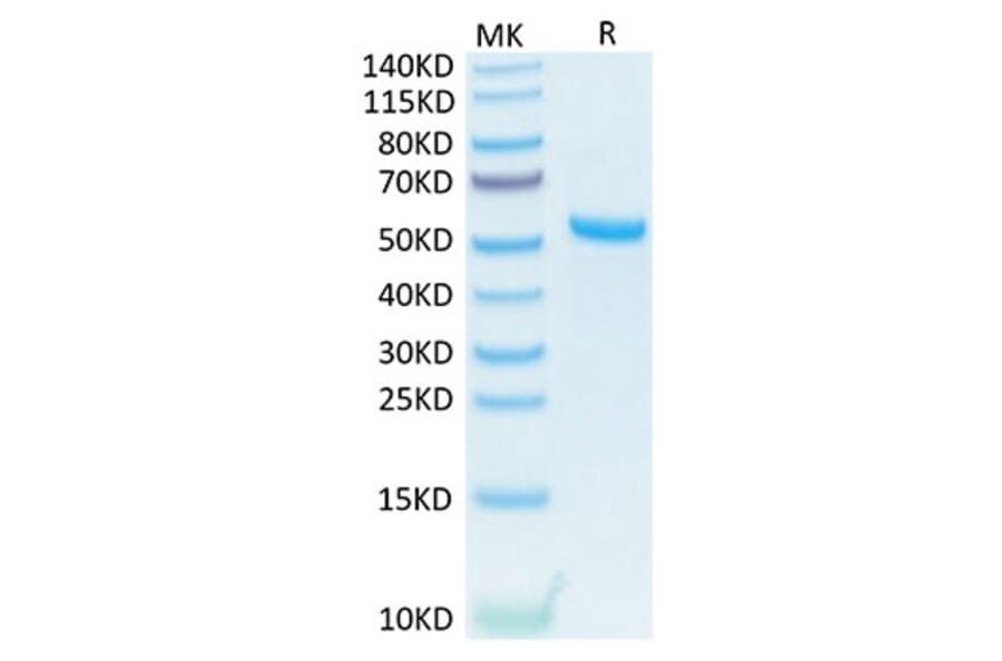 Tris-Bis PAGE - Recombinant Human TNFSF13 Protein (N-terminal His and Flag Tag) (A331354) - Antibodies.com