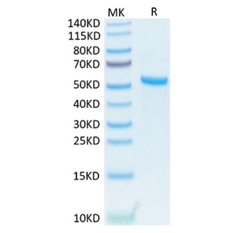 Tris-Bis PAGE - Recombinant Human TNFSF13 Protein (N-terminal His and Flag Tag) (A331354) - Antibodies.com