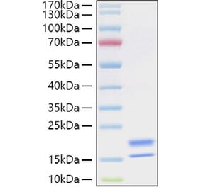 SDS-PAGE - Recombinant Human TNFSF18 Protein (C-terminal His Tag) (A331356) - Antibodies.com