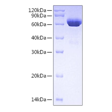 SDS-PAGE - Recombinant Human tPA Protein (C-terminal His Tag) (A331359) - Antibodies.com