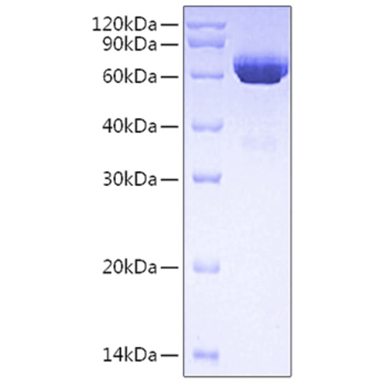 SDS-PAGE - Recombinant Human tPA Protein (C-terminal His Tag) (A331359) - Antibodies.com