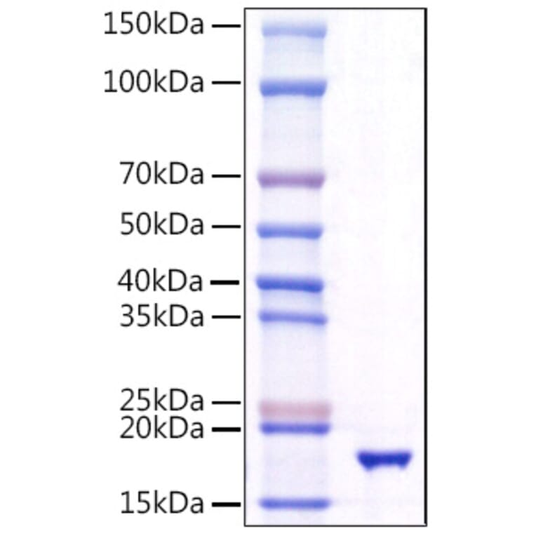 SDS-PAGE - Recombinant Human TRAIL Protein (A331361) - Antibodies.com