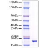 SDS-PAGE - Recombinant Human TRAIL Protein (A331361) - Antibodies.com