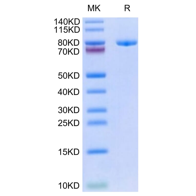 Tris-Bis PAGE - Recombinant Human Transferrin Receptor Protein (Biotin) (N-terminal His and Avi Tag) (A331364) - Antibodies.com