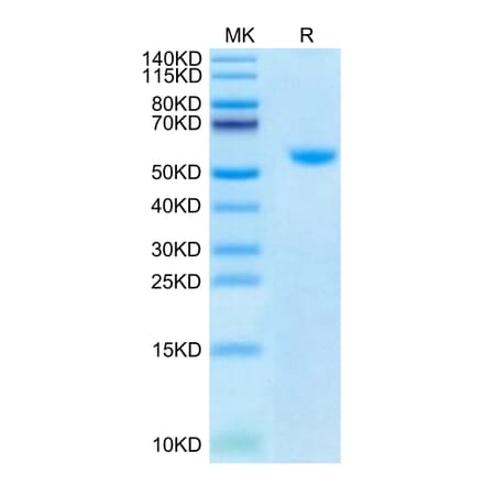 Tris-Bis PAGE - Recombinant Human TRAP/CD40L Protein (Biotin) (N-terminal His and Flag Tag) (A331367) - Antibodies.com