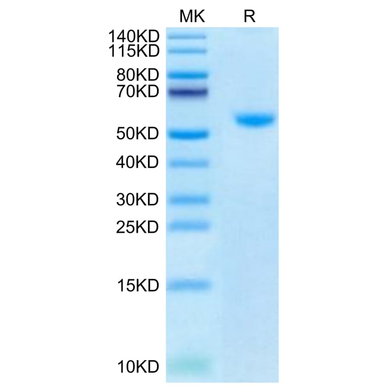 Tris-Bis PAGE - Recombinant Human TRAP/CD40L Protein (Biotin) (N-terminal His and Flag Tag) (A331367) - Antibodies.com
