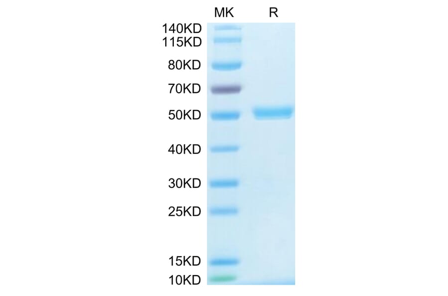 Tris-Bis PAGE - Recombinant Human TRAP/CD40L Protein (N-terminal His and Flag Tag) (A331368) - Antibodies.com