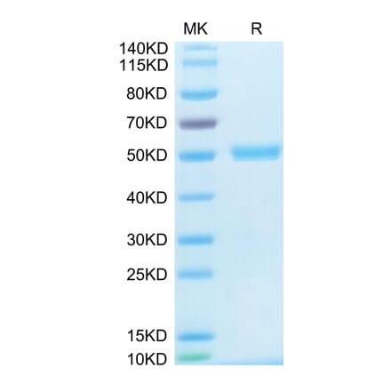 Tris-Bis PAGE - Recombinant Human TRAP/CD40L Protein (N-terminal His and Flag Tag) (A331368) - Antibodies.com