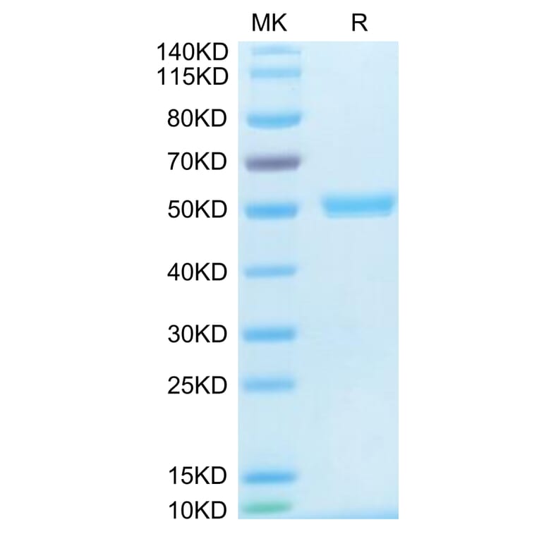 Tris-Bis PAGE - Recombinant Human TRAP/CD40L Protein (N-terminal His and Flag Tag) (A331368) - Antibodies.com