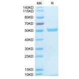 Tris-Bis PAGE - Recombinant Human TRAP/CD40L Protein (N-terminal His and Flag Tag) (A331368) - Antibodies.com