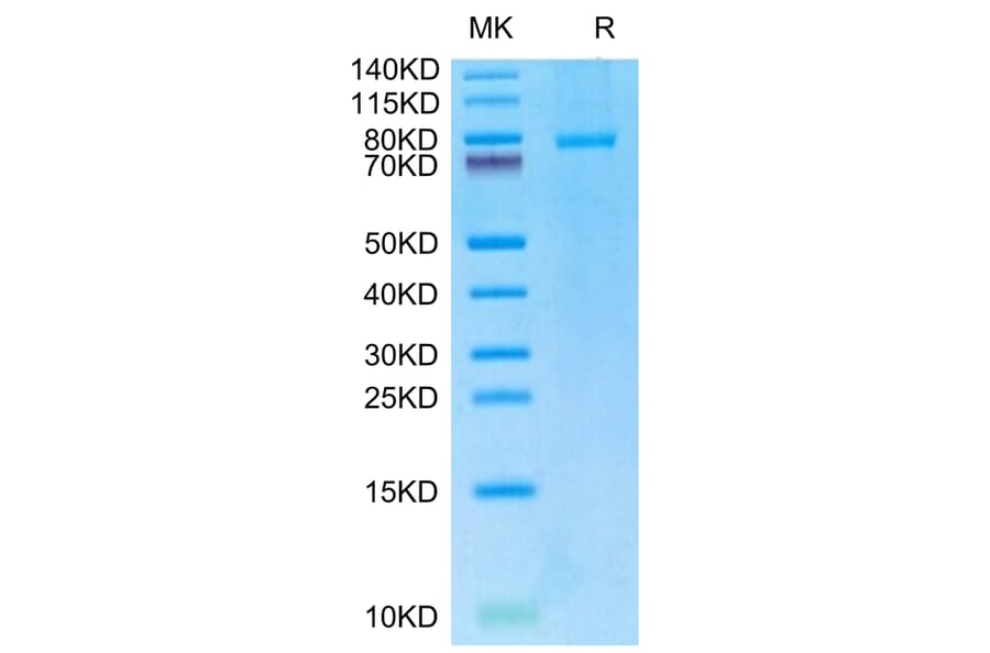 Tris-Bis PAGE - Recombinant Human TRAP/CD40L Protein (N-terminal monomeric Human Fc Tag) (A331369) - Antibodies.com