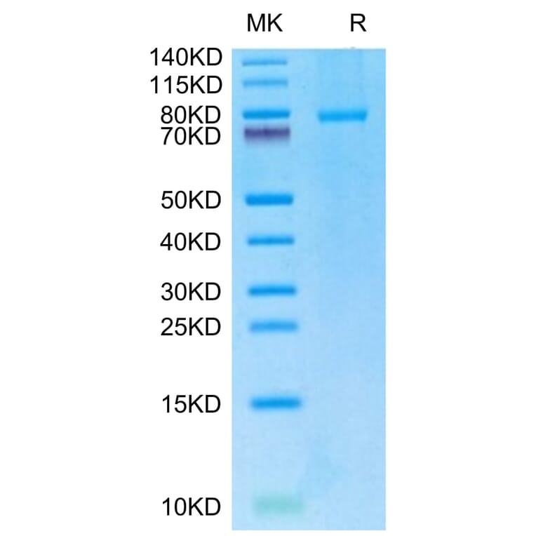 Tris-Bis PAGE - Recombinant Human TRAP/CD40L Protein (N-terminal monomeric Human Fc Tag) (A331369) - Antibodies.com