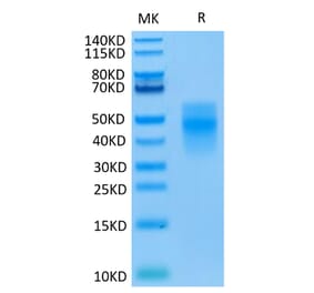Tris-Bis PAGE - Recombinant Human TREM1 Protein (C-terminal His Tag) (A331370) - Antibodies.com