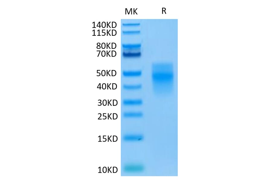 Tris-Bis PAGE - Recombinant Human TREM1 Protein (C-terminal His Tag) (A331370) - Antibodies.com