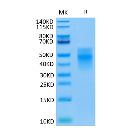 Tris-Bis PAGE - Recombinant Human TREM1 Protein (C-terminal His Tag) (A331370) - Antibodies.com