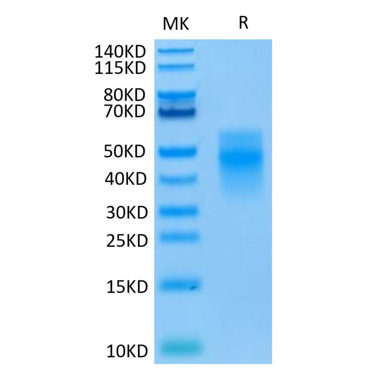 Tris-Bis PAGE - Recombinant Human TREM1 Protein (C-terminal His Tag) (A331370) - Antibodies.com