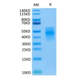 Tris-Bis PAGE - Recombinant Human TREM1 Protein (C-terminal His Tag) (A331370) - Antibodies.com