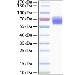 SDS-PAGE - Recombinant Human TREM1 Protein (C-terminal Human Fc and His Tag) (A331371) - Antibodies.com