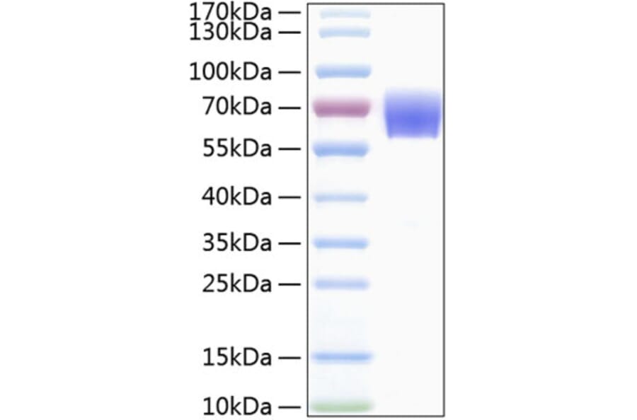 SDS-PAGE - Recombinant Human TREM1 Protein (C-terminal Human Fc and His Tag) (A331371) - Antibodies.com