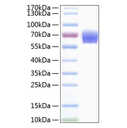SDS-PAGE - Recombinant Human TREM1 Protein (C-terminal Human Fc and His Tag) (A331371) - Antibodies.com