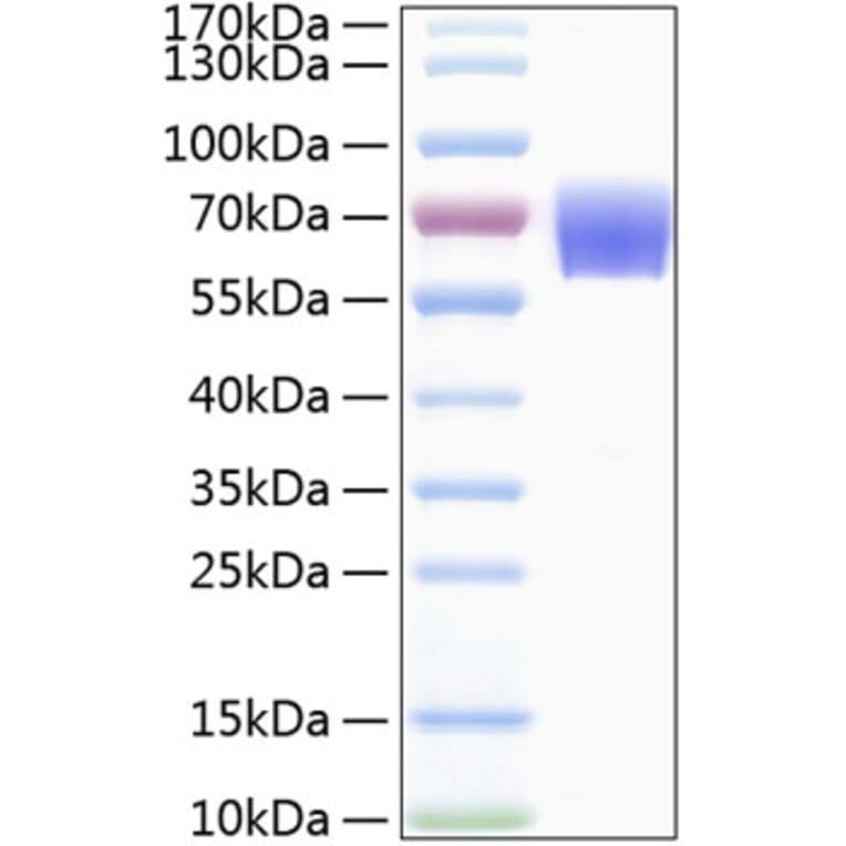 SDS-PAGE - Recombinant Human TREM1 Protein (C-terminal Human Fc and His Tag) (A331371) - Antibodies.com
