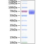 SDS-PAGE - Recombinant Human TREM1 Protein (C-terminal Human Fc and His Tag) (A331371) - Antibodies.com