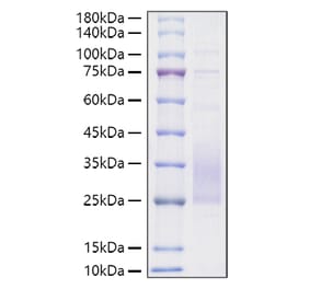 SDS-PAGE - Recombinant Mouse TREM2 Protein (C-terminal His Tag) (A331372) - Antibodies.com