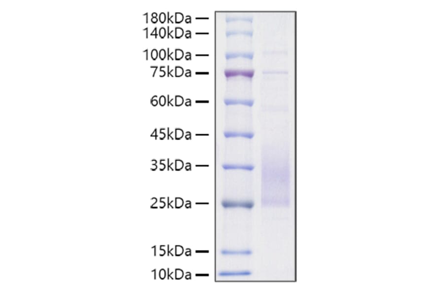 SDS-PAGE - Recombinant Mouse TREM2 Protein (C-terminal His Tag) (A331372) - Antibodies.com