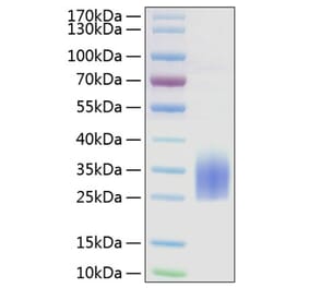 SDS-PAGE - Recombinant Human TREM2 Protein (C-terminal His Tag) (A331373) - Antibodies.com