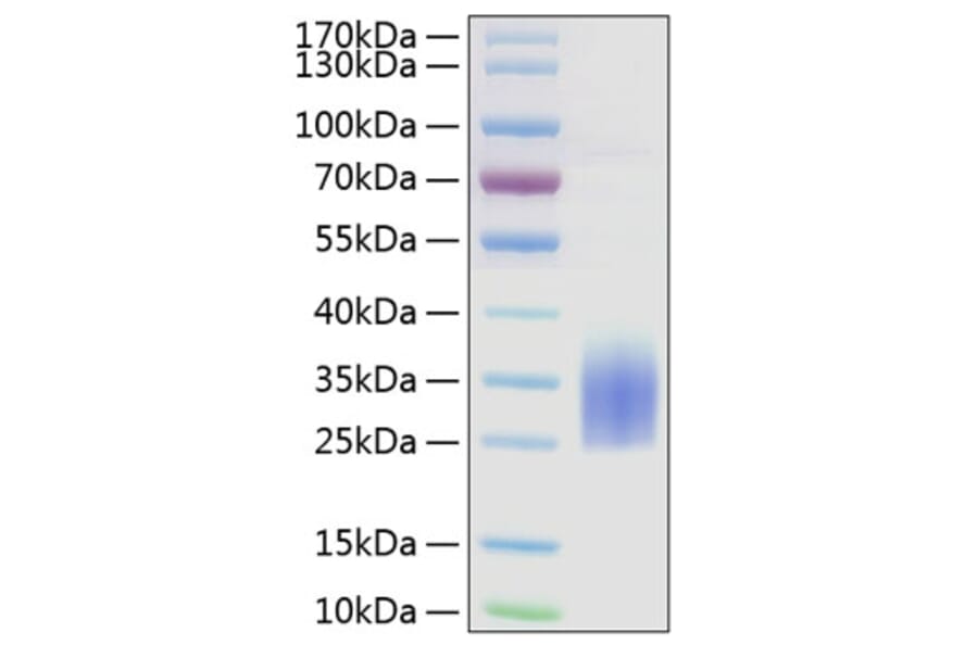 SDS-PAGE - Recombinant Human TREM2 Protein (C-terminal His Tag) (A331373) - Antibodies.com