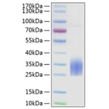SDS-PAGE - Recombinant Human TREM2 Protein (C-terminal His Tag) (A331373) - Antibodies.com