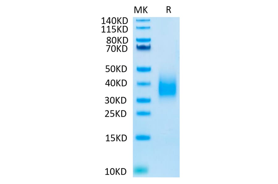 Tris-Bis PAGE - Recombinant Human TREM2 Protein (Biotin) (C-terminal His and Avi Tag) (A331374) - Antibodies.com