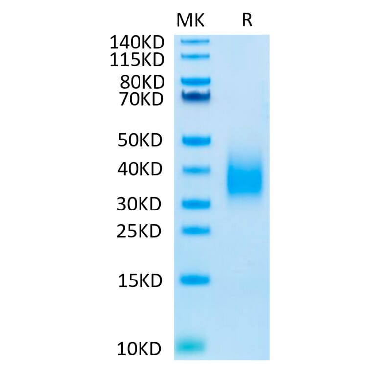 Tris-Bis PAGE - Recombinant Human TREM2 Protein (Biotin) (C-terminal His and Avi Tag) (A331374) - Antibodies.com